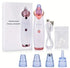 Original Blackhead Remover Pore Vacuum – Deep Pore Suction Cleanser for Face, Nose, T-Zone, Chin, Forehead, Cheeks, Ideal for Home Spa, Daily Routine, Makeup Prep, Travel, and Self-Care Gift