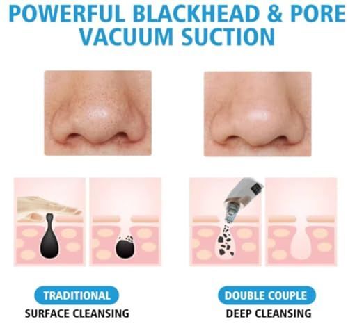 Original Blackhead Remover Pore Vacuum – Deep Pore Suction Cleanser for Face, Nose, T-Zone, Chin, Forehead, Cheeks, Ideal for Home Spa, Daily Routine, Makeup Prep, Travel, and Self-Care Gift