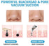 Original Blackhead Remover Pore Vacuum – Deep Pore Suction Cleanser for Face, Nose, T-Zone, Chin, Forehead, Cheeks, Ideal for Home Spa, Daily Routine, Makeup Prep, Travel, and Self-Care Gift