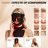 Red Light Therapy for Face and Neck Mask,160 LED Beads Silicone Facial Light Therapy,Rechargeable Portable LED Skincare Mask with Remote Control,Timer & 3 Adjustable Brightness