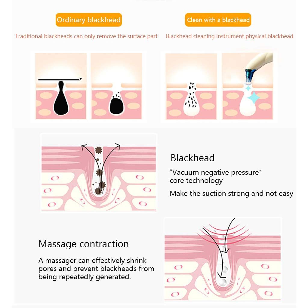 Electric Cleaner  Vacuum Pore Suction Face Beauty Instrument Head Sucker with Camera (White, One Size)