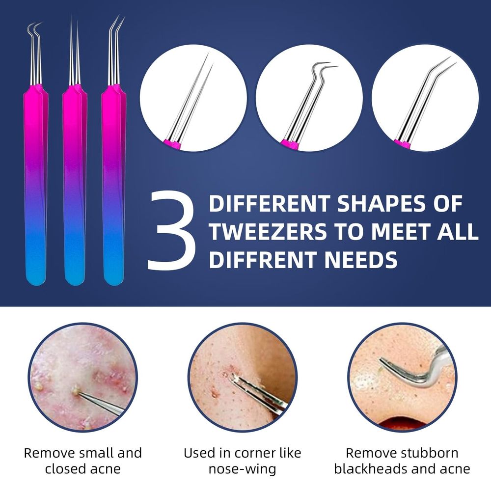 Blackhead Remover Extractor Tool,10 Pcs Professional Pimple Popper Tool Kit with Metal Case for Quick and Easy Removal of Blackheads,Pimples,Zit Removing,Facial and Nose(Colorful)
