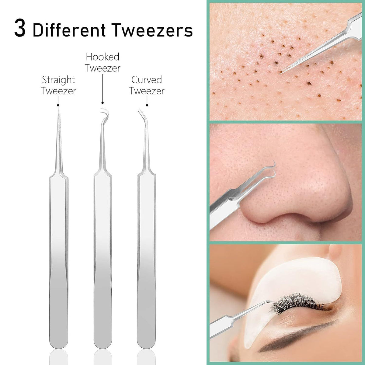 Blackhead Remover Comedone Pimple Popper Tool Acne Extractor Blemish Remover Ingrown Hair Tweezers Removal Kit Whitehead Remover Zit Treatment Skincare Tools for Face Nose,8 PCS