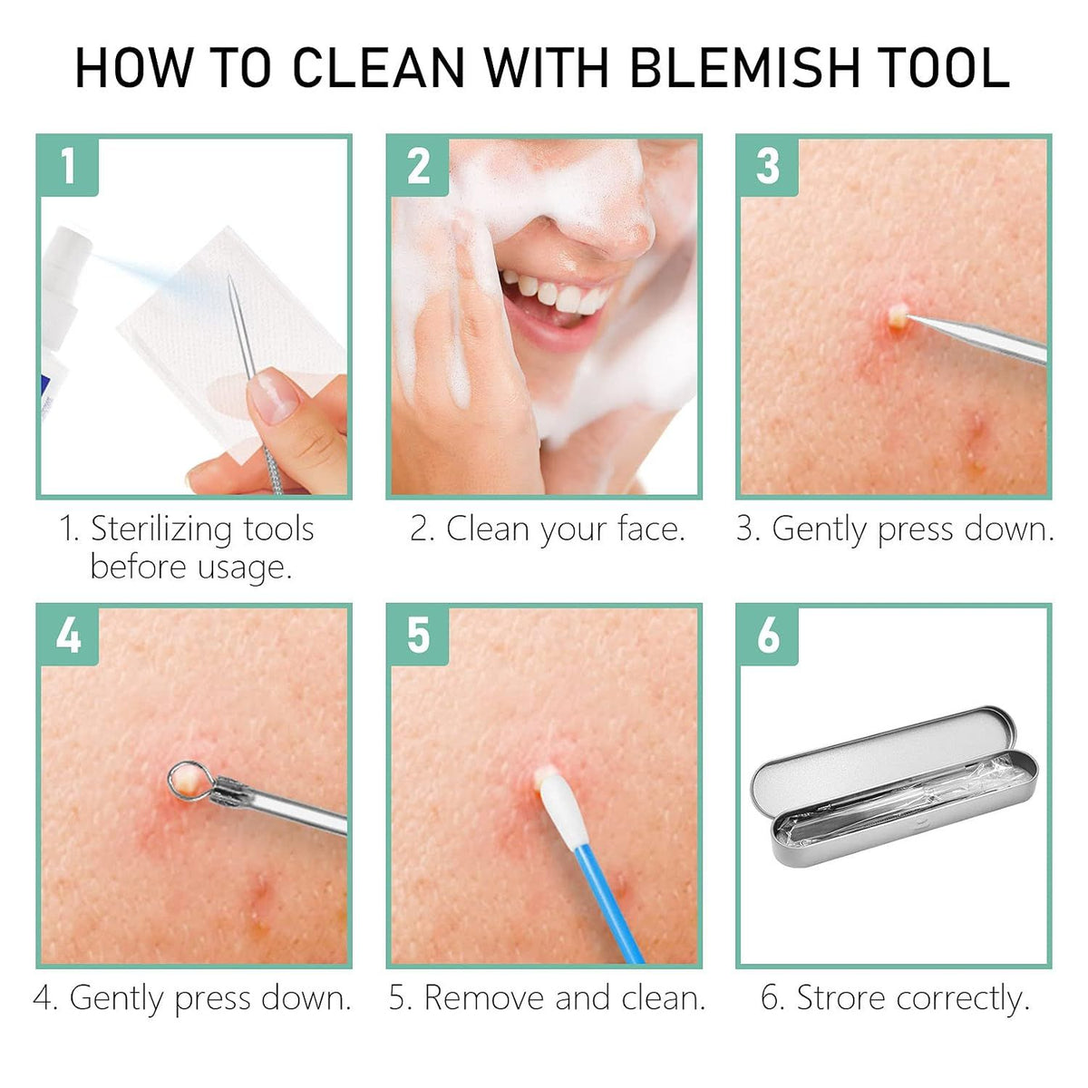 Blackhead Remover Comedone Pimple Popper Tool Acne Extractor Blemish Remover Ingrown Hair Tweezers Removal Kit Whitehead Remover Zit Treatment Skincare Tools for Face Nose,8 PCS