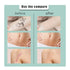 South moon Birthmark Skin Tone Concealer, Cover Body Scars Tattoo Spots Waterproof Color Masking Tape