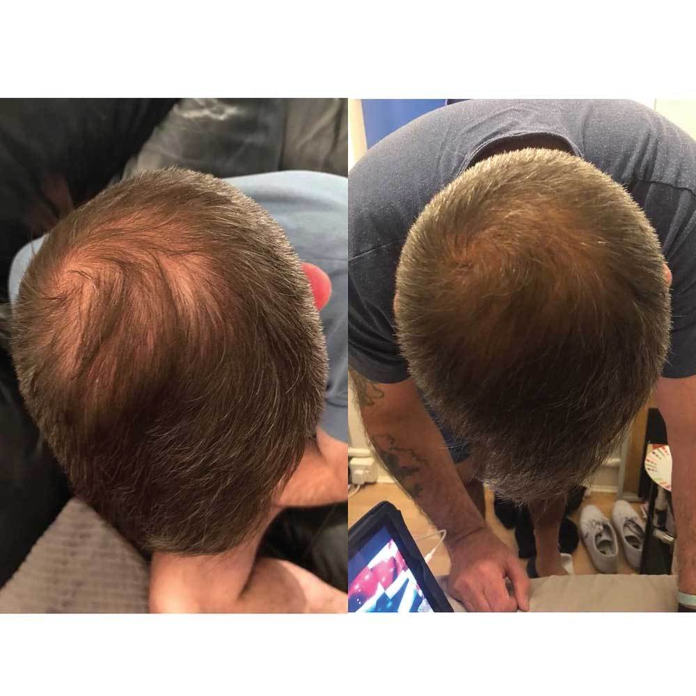 Grow More Elixir 100ml Hair Growth Serum Biotin Regrowth Topical Scalp