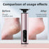 Rose Glod Rechargeable Electric Foot File with 9 Speed Settings - Callus Remover for Smooth Feet
