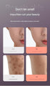 Professional 9-Level Skin Tag & Spot Remover Pen - USB Rechargeable Beauty Device(Pink)