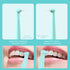 Intelligent High-Frequency Vibration Dental Calculus & Stain Remover(black)