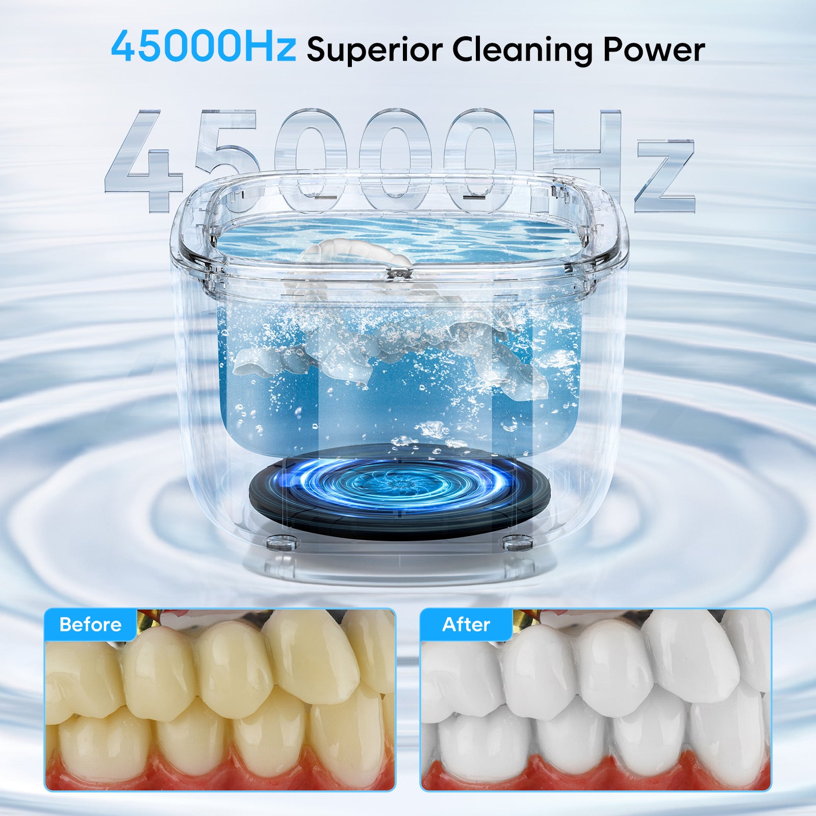 Professional Ultrasonic Cleaner with UV Light - 45000Hz for Dentures, Retainers, Jewelry & More(white)