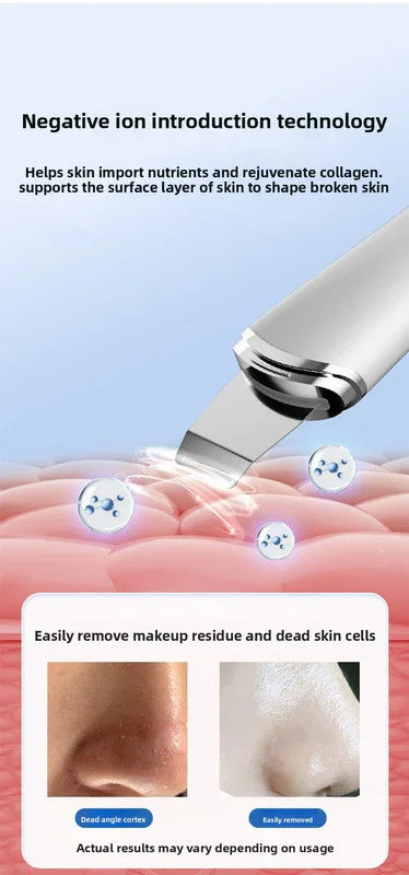 Ultrasonic Skin Scrubber Facial Spatula Blackhead Remover & Pore Cleaner with Ion EMS Lifting Mode Rechargeable Beauty Tool Pink