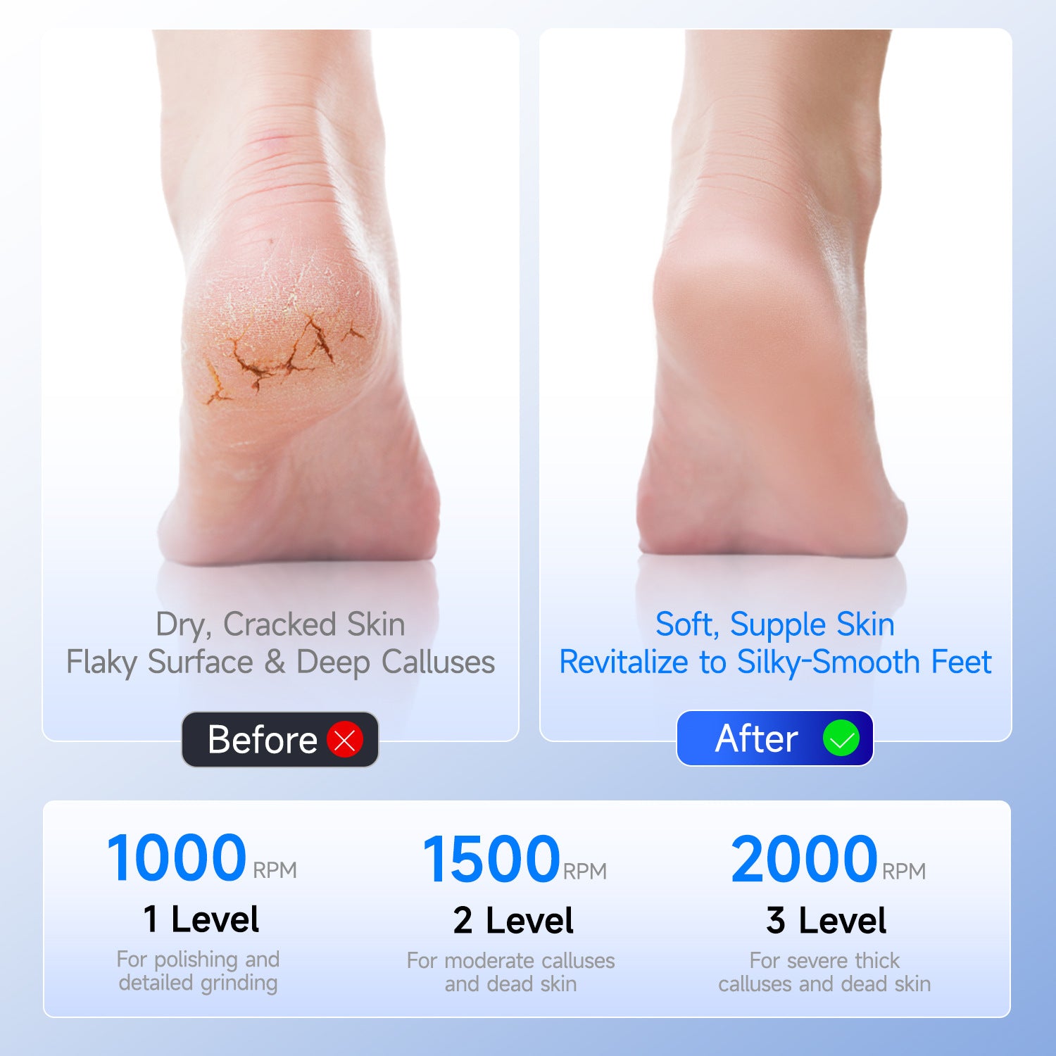 White A1 Compact Electric Foot Dead Skin and Callus Remover - IPX6 Pedicure Tool with 3-Speed Mode & Dual 360°Rotating Stainless Steel Heads