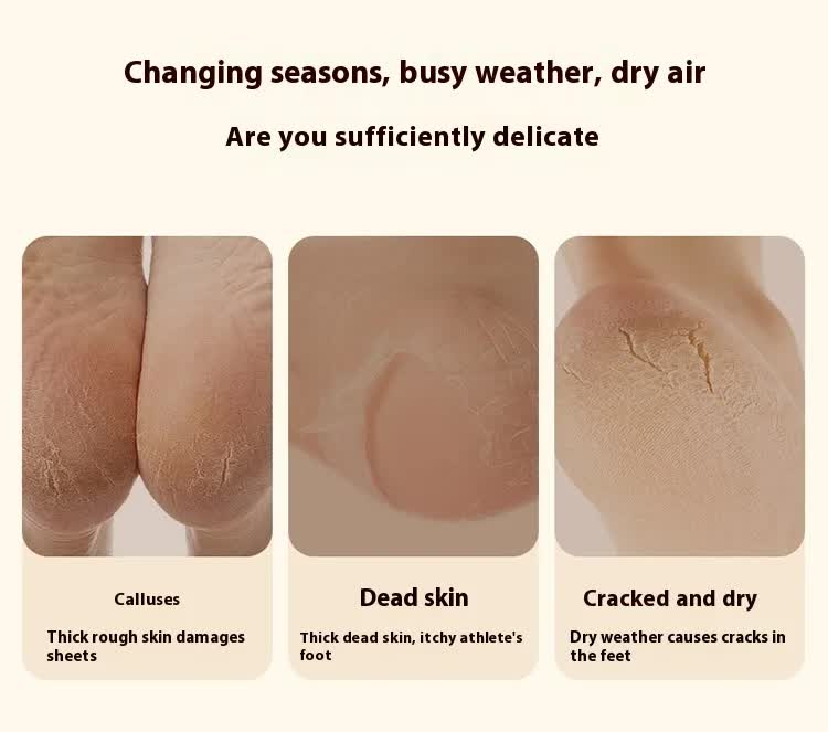 Electric Foot Callus Remover Rechargeable Pedicure Tool with 3 Grinding Heads Portable Dead Skin Exfoliator Ivory White