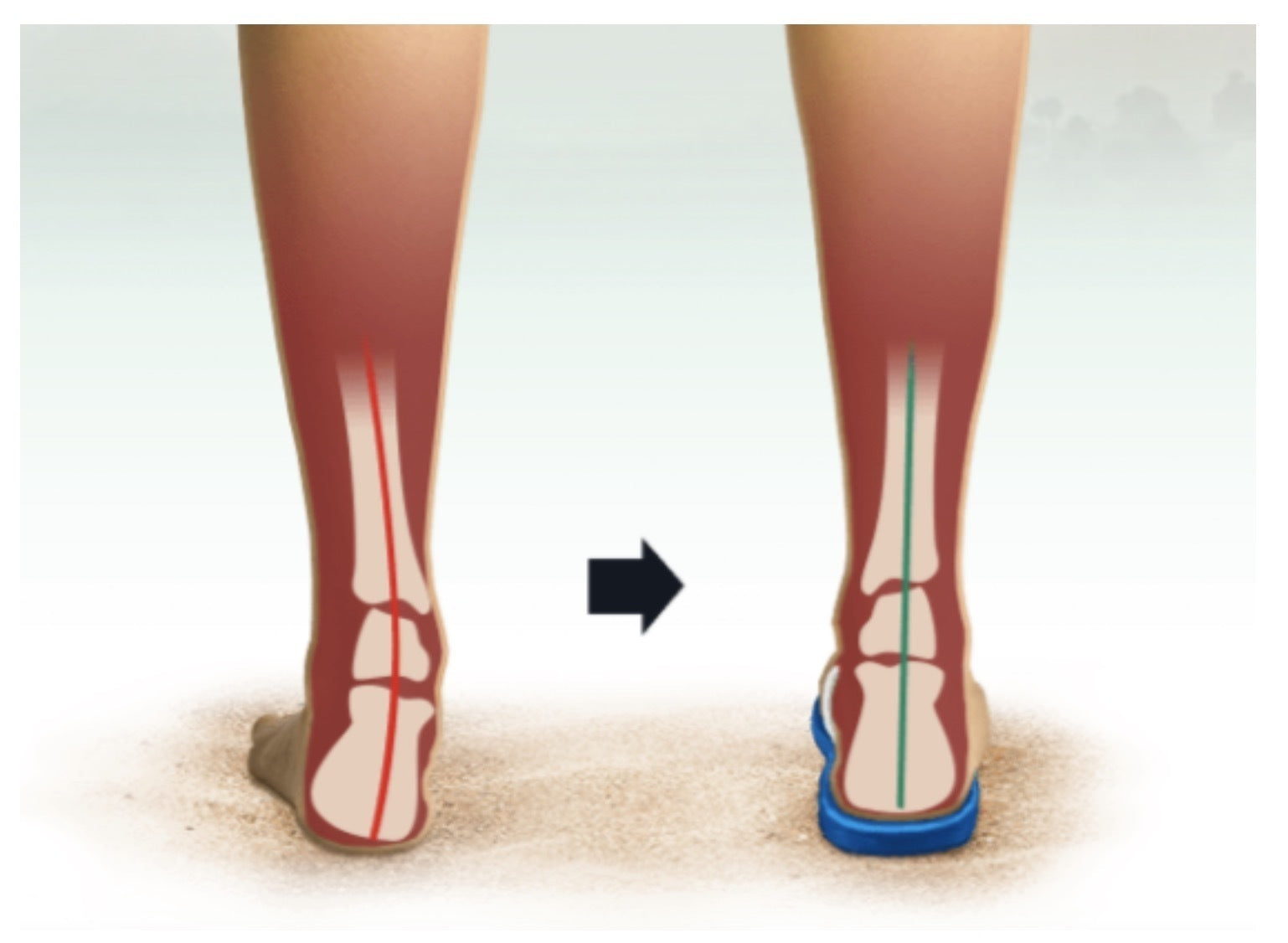 Orthotic Thongs Arch Support Shoes Footwear Flip Flops Orthopedic - Black/Black - EUR 37